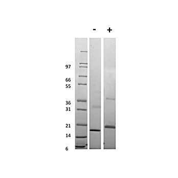 Human Tumor Necrosis Factor Receptor Type 1 Recombinant Protein