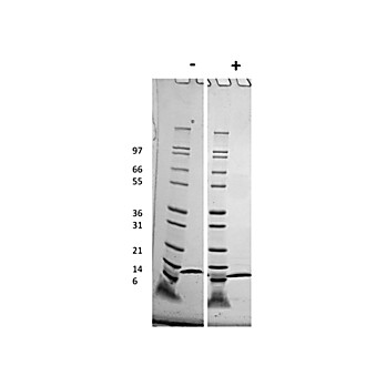 Human ITAC (CXCL11) Recombinant Protein