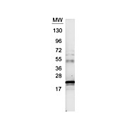 Anti-Human IL-6 (RABBIT) Antibody