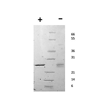 Mouse Epstein-Barr Virus Induced Gene 3 Recombinant Protein