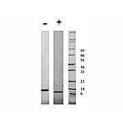 Human Connective Tissue Growth Factor Recombinant Protein