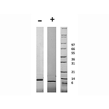 Human Connective Tissue Growth Factor Recombinant Protein