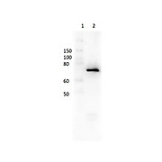 Anti-DEXTRANASE (Penicillium species) (RABBIT) Antibody Biotin Conjugated