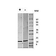 Human Fibroblast Growth Factor 147 basic Recombinant Protein