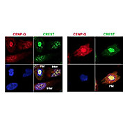 Anti-CENP-Q (RABBIT) Antibody