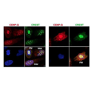 Anti-CENP-Q (RABBIT) Antibody