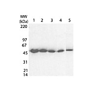 Anti-tetanus toxic fragment C (Rabbit) Antibody