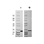 Mouse Fibroblast Growth Factor basic Recombinant Protein