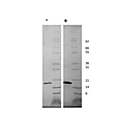 Human Fibroblast Growth Factor-22 Recombinant Protein