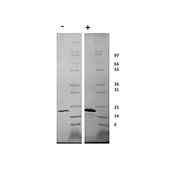 Human Fibroblast Growth Factor-22 Recombinant Protein