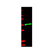 Anti-Human IL-1 Receptor Type II (IL-1RII) (RABBIT) Antibody
