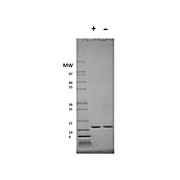 Human Interferon-alpha 2a Recombinant Protein