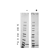 Human Macrophage Inflammatory Protein-4 (CCL18) Recombinant Protein