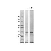 Rat Monocyte Chemotactic Protein-1 (CCL2) Recombinant Protein