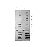 Human Growth Hormone Recombinant Protein
