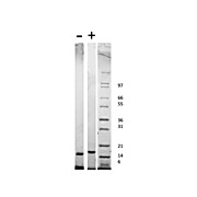 Rat Stem Cell Factor Recombinant Protein