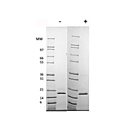 Human Fibroblast Growth Factor 154 basic Recombinant Protein (Animal Free)