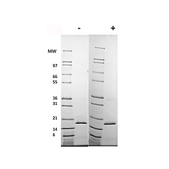 Human Fibroblast Growth Factor 154 basic Recombinant Protein (Animal Free)