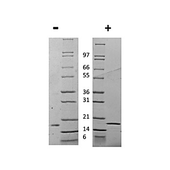 Rat Interleukin-1 beta Recombinant Protein
