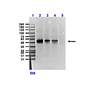 Anti-SUCROSE PHOSPHORYLASE (E.coli) (GOAT) Antibody