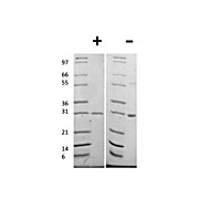 Human Galectin-3 Recombinant Protein