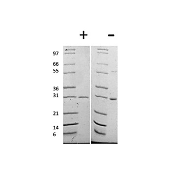 Human Galectin-3 Recombinant Protein