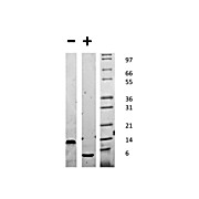 Mouse Epidermal Growth Factor Recombinant Protein