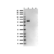 AKT1 [14E5.A2.B2.H9] Antibody