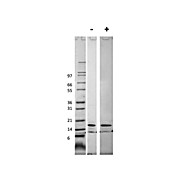 Mouse Monocyte Chemotactic Protein-1 (CCL2) Recombinant Protein