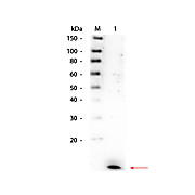 Anti-Human IL-8 (RABBIT) Antibody