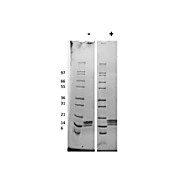 Mouse Thrombopoietin Recombinant Protein