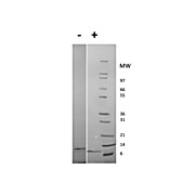 Rat Epidermal Growth Factor Recombinant Protein