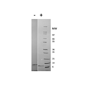 Rat Epidermal Growth Factor Recombinant Protein