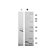 Human Interleukin-17AF Heterodimer Recombinant Protein