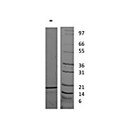 Human Interleukin-19 Recombinant Protein