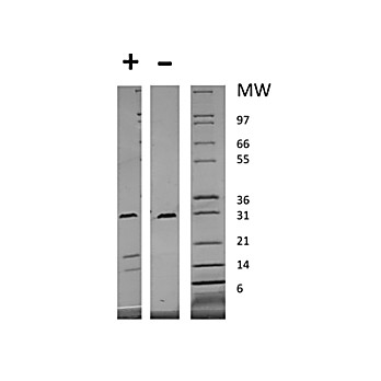 Human Platelet Derived Growth Factor-AB Recombinant Protein (Animal Free)