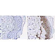 Anti-BETA-2-MICROGLOBULIN (Human Urine) (RABBIT) Antibody