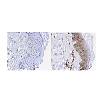 Anti-BETA-2-MICROGLOBULIN (Human Urine) (RABBIT) Antibody