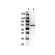 Anti-DEXTRANASE (Penicillium species) (RABBIT) Antibody Peroxidase Conjugated