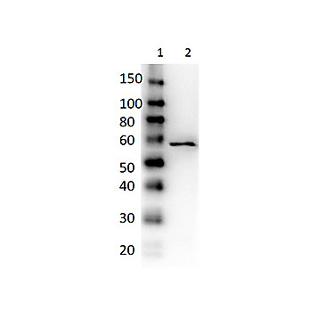 Anti-DEXTRANASE (Penicillium species) (RABBIT) Antibody Peroxidase Conjugated