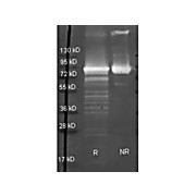 Anti-MALTOSE PHOSPHORYLASE (E.coli) (GOAT) Antibody