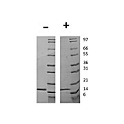Human Granulocyte Colony Stimulating Factor Recombinant Protein