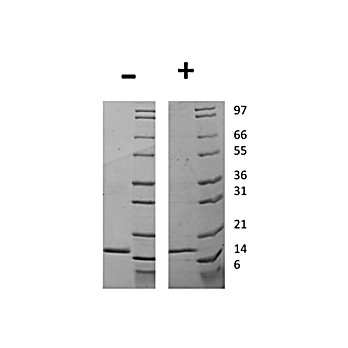 Human Granulocyte Colony Stimulating Factor Recombinant Protein