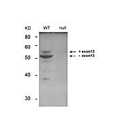BIN1 Antibody [99D]