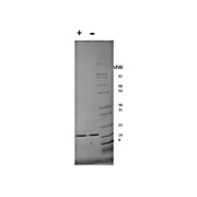 Human Interferon-alpha 2b Recombinant Protein