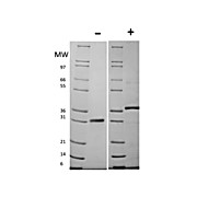 Mouse Follistatin Recombinant Protein