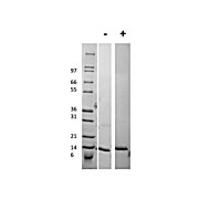 Human Procalcitonin Recombinant Protein