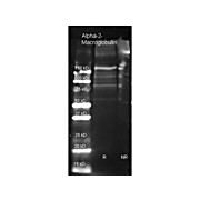 Anti-Alpha-2-MACROGLOBULIN (Human Plasma) (GOAT) Antibody Biotin Conjugated