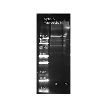 Anti-Alpha-2-MACROGLOBULIN (Human Plasma) (GOAT) Antibody Biotin Conjugated