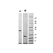 Human Glial Derived Neurotrophic Factor Recombinant Protein